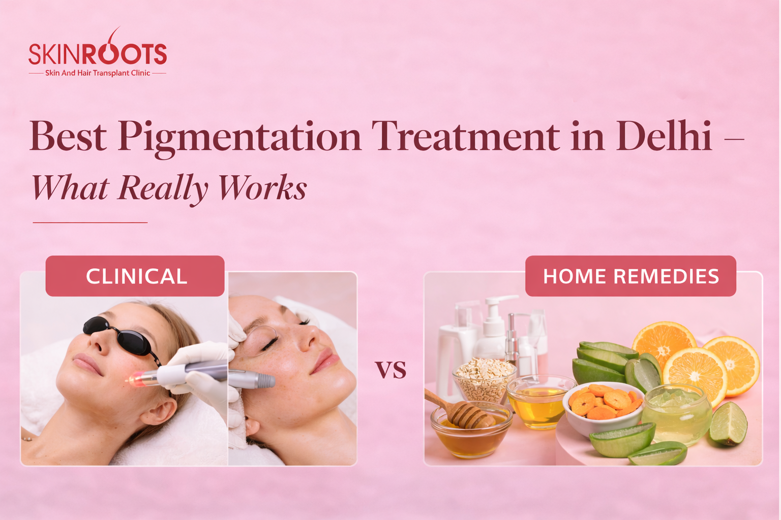 Best Pigmentation Treatment in Delhi